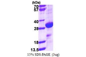 SDS-PAGE (SDS) image for Density-Regulated Protein (DENR) (AA 1-198) protein (His tag) (ABIN667552)