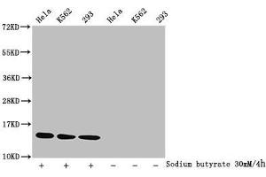 Western Blot Detected samples: Hela whole cell lysate, K562 whole cell lysate, 293 whole cell lysate, Untreated (-) or treated (+) with 30 mM sodium butyrate for 4h All lanes: HIST1H2BC antibody at 1:1000 Secondary Goat polyclonal to rabbit IgG at 1/40000 dilution Predicted band size: 14 kDa Observed band size: 14 kDa (Histone H2B antibody  (acLys15))