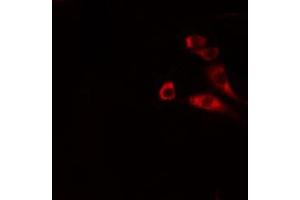 ABIN6266680 staining MCF-7 cells by IF/ICC.