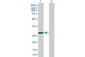 Western Blot analysis of CLIC2 expression in transfected 293T cell line by CLIC2 MaxPab polyclonal antibody. (CLIC2 antibody  (AA 1-247))