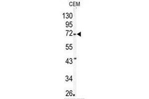 Image no. 1 for anti-Matrix Metallopeptidase 24 (Membrane-inserted) (MMP24) (Middle Region) antibody (ABIN358694) (MMP24 antibody  (Middle Region))
