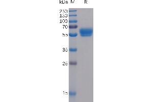 Human 4-1BB Ligand Protein, mFc-His Tag on SDS-PAGE under reducing condition. (TNFSF9 Protein (mFc-His Tag))