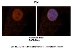 Sample Type :  Human brain stem cells  Primary Antibody Dilution :  1:500  Secondary Antibody :  Goat anti-rabbit Alexa-Fluor 594  Secondary Antibody Dilution :  1:1000  Color/Signal Descriptions :  VIM: Red DAPI:Blue  Gene Name :  VIM  Submitted by :  Dr. (Vimentin antibody  (N-Term))