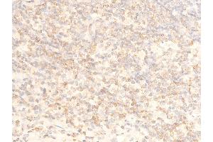 ABIN6267069 at 1/100 staining human appendiceal tissue sections by IHC-P. (NFKBIA antibody  (pSer32, pSer36))