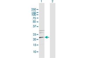 Western Blot analysis of MRPS34 expression in transfected 293T cell line by MRPS34 MaxPab polyclonal antibody. (MRPS34 antibody  (AA 1-218))