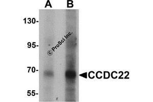 Western Blotting (WB) image for anti-Coiled-Coil Domain Containing 22 (CCDC22) (N-Term) antibody (ABIN1031304) (CCDC22 antibody  (N-Term))