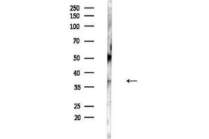 anti-Solute Carrier Family 25 (Mitochondrial Carrier, Oxoglutarate Carrier), Member 11 (SLC25A11) (Internal Region) antibody