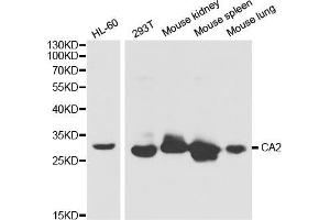 Western blot analysis of extracts of various cell lines, using CA2 antibody (ABIN5970672) at 1/1000 dilution. (CA2 antibody)