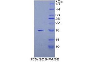 SDS-PAGE (SDS) image for Fatty Acid Binding Protein 4, Adipocyte (FABP4) (AA 2-132) protein (His tag) (ABIN2124776)