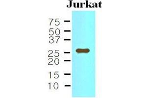 The Cell lysates of Jurkat (35 ug) were resolved by SDS-PAGE, transferred to nitrocellulose membrane and probed with anti-human IL-33 (1:500). (IL-33 antibody  (AA 112-270))