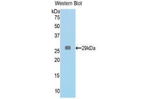 Western Blotting (WB) image for anti-Galactosidase, beta 1 (GLB1) (AA 192-432) antibody (ABIN1859021) (GLB1 antibody  (AA 192-432))