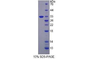 SDS-PAGE (SDS) image for Glutaminyl-tRNA Synthetase (QARS) (AA 514-775) protein (His tag) (ABIN6239228)
