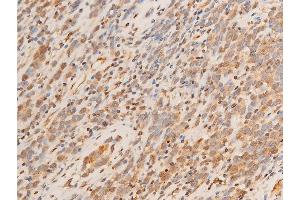 Immunohistochemistry (IHC) image for anti-serum/glucocorticoid Regulated Kinase 1 (SGK1) (pSer422) antibody (ABIN6256329)