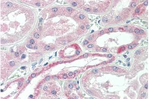 ABIN302157 (5µg/ml) staining of paraffin embedded Human Kidney. (USP43 antibody  (Internal Region))
