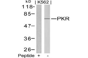 Image no. 1 for anti-Eukaryotic Translation Initiation Factor 2-alpha Kinase 2 (EIF2AK2) (Thr446) antibody (ABIN197544)