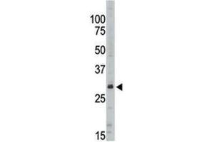 Western blot analysis of SIRT5 antibody in Jurkat lysate (SIRT5 antibody  (AA 263-292))