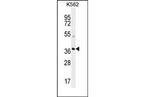 Western blot analysis using SFRP4 Antibody (C-term) Cat. (SFRP4 antibody  (C-Term))