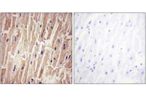 Immunohistochemistry analysis of paraffin-embedded human heart , using YAP (Phospho-Ser127) Antibody. (YAP1 antibody  (pSer127))