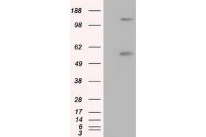 Western Blotting (WB) image for anti-Atrial Natriuretic Peptide Receptor 3 (NPR3) antibody (ABIN1499807)