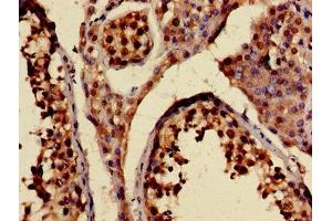 Immunohistochemistry of paraffin-embedded human testis tissue using ABIN7157612 at dilution of 1:100 (KIF2A antibody  (AA 161-294))