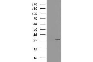 Western Blotting (WB) image for anti-Adenylate Kinase 3 (AK3) antibody (ABIN1496522) (Adenylate Kinase 3 antibody)