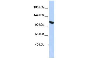 UBA1 antibody used at 1 ug/ml to detect target protein. (UBA1 antibody  (N-Term))