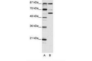 Image no. 1 for anti-K(lysine) Acetyltransferase 2B (KAT2B) (AA 190-239) antibody (ABIN202927) (KAT2B antibody  (AA 190-239))
