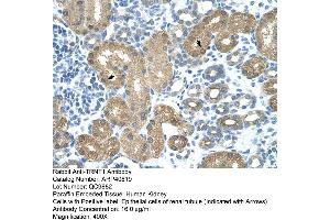 Rabbit Anti-TRNT1 Antibody  Paraffin Embedded Tissue: Human Kidney Cellular Data: Epithelial cells of renal tubule Antibody Concentration: 4. (Trnt1 antibody  (N-Term))
