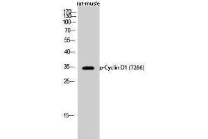 Western Blotting (WB) image for anti-Cyclin D1 (CCND1) (pThr286) antibody (ABIN3172999) (Cyclin D1 antibody  (pThr286))