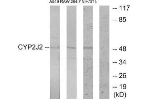 Western Blotting (WB) image for anti-Cytochrome P450, Family 2, Subfamily J, Polypeptide 2 (CYP2J2) (Internal Region) antibody (ABIN1850360) (CYP2J2 antibody  (Internal Region))