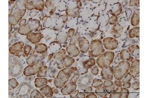 Immunoperoxidase of monoclonal antibody to FBXL18 on formalin-fixed paraffin-embedded human salivary gland. (FBXL18 antibody  (AA 1-110))