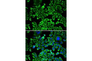 Immunofluorescence analysis of A549 cells using EIF4B antibody. (EIF4B antibody)