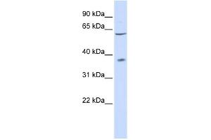 WB Suggested Anti-P2RX2 Antibody Titration:  0. (P2RX2 antibody  (N-Term))
