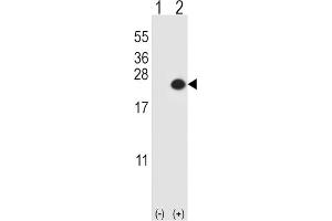 Western Blotting (WB) image for anti-Dual Specificity Phosphatase 3 (DUSP3) antibody (ABIN3003774) (Dual Specificity Phosphatase 3 (DUSP3) antibody)