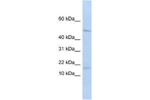 VPREB1 antibody used at 1 ug/ml to detect target protein. (VPREB1 antibody  (Middle Region))