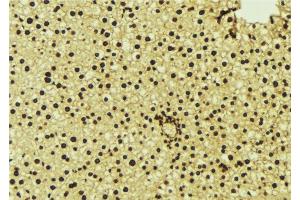ABIN6277123 at 1/100 staining Mouse liver tissue by IHC-P. (NR1H3 antibody  (C-Term))