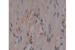 Used in DAB staining on fromalin fixed paraffin- embedded skeletal muscle tissue (FLII antibody  (AA 896-1176))