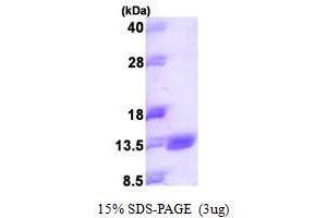SDS-PAGE (SDS) image for S100 Calcium Binding Protein A14 (S100A14) (AA 1-104) protein (His tag) (ABIN667389) (S100A14 Protein (AA 1-104) (His tag))