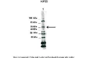Lanes:   1. (KIF22 antibody  (N-Term))