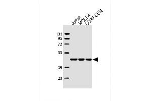 Lane 1: Jurkat, Lane 2: MOLT-4, Lane 3: CCRF-CEM cell lysate at 20 µg per lane, probed with bsm-51447M ADA (608CT2. (ADA antibody)