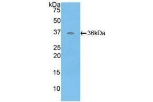 Detection of Recombinant ATP6AP2, Human using Polyclonal Antibody to ATPase, H+ Transporting, Lysosomal Accessory Protein 2 (ATP6AP2) (ATP6AP2 antibody  (AA 17-302))