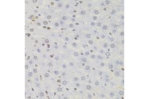 Immunohistochemistry of paraffin-embedded rat liver using AKAP8 antibody (ABIN5975842) (40x lens). (AKAP8 antibody)