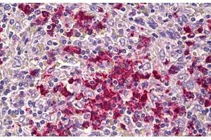 Anti-CDH23 antibody IHC staining of human spleen. (CDH23 antibody  (AA 61-110))