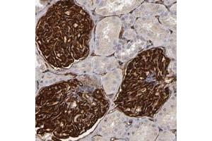 Immunohistochemical staining of human kidney with SLC9A3R2 polyclonal antibody  shows distinct membranous positivity in cells in glomeruli at 1:200-1:500 dilution. (SLC9A3R2 antibody)