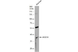 ACOT8 antibody