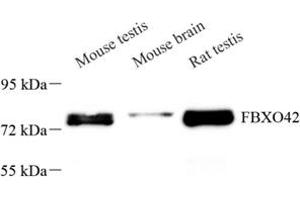 Western blot analysis of FBXO42 (ABIN7073905) at dilution of 1: 200 (FBXO42 antibody)