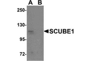 Western blot analysis of SCUBE1 in Daudi cell lysate with SCUBE1 antibody at 1 μg/ml in (A) the absence and (B) the presence of blocking peptide. (SCUBE1 antibody  (Center))