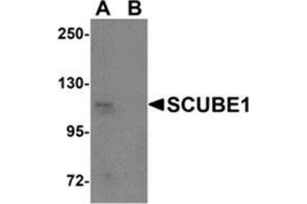 SCUBE1 anticorps  (Center)