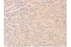 Detection of SIRT6 in Mouse Kidney Tissue using Polyclonal Antibody to Sirtuin 6 (SIRT6) (SIRT6 antibody  (AA 1-334))