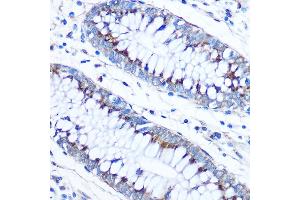 Immunohistochemistry of paraffin-embedded Human colon using FD Rabbit pAb (ABIN7267116) at dilution of 1:50 (40x lens).